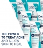 CERAVE ACNE FOAMING CREAM CLEANSER 150ML